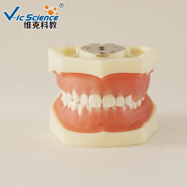 Buy Peridontal Disease Teeth Study Model Human Dental Model Gingival Diseases at wholesale prices