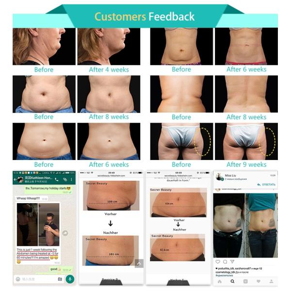 2018 hottest CE approved cryolipolysis fat freezing weight loss clinic beauty machine with cavitaion, RF, cool sculpting