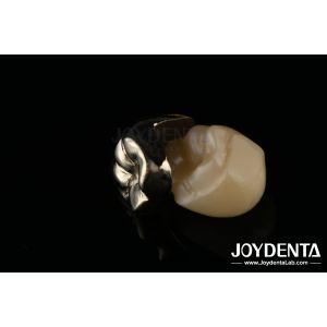 Oral Rehabilitation Wax Casting FMC Full Metal Crown For Dental Clinical Repair