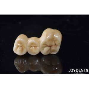 High Biocompatibility Zirconia Full Contour Crown Perfect Fit High Strength
