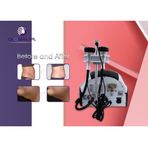 Face / Neck Lifting RF Cavitation Slimming Machine Weight Reduction Beauty
