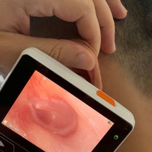 Ear Otoscope Digital Video Otoscope Camera Otoscope Set Ear Endoscope