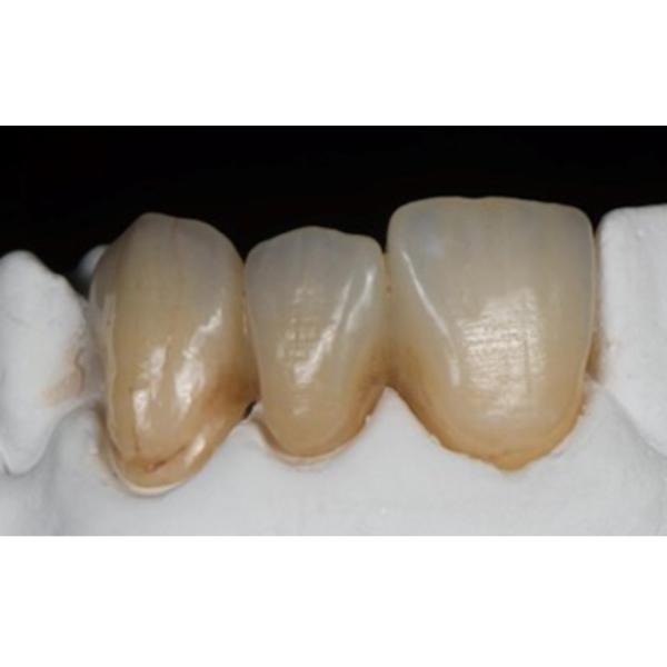 49% UT Multilayer Zirconia Disc Ultra Translucent 600 Mpa Dental Ceramic Blocks