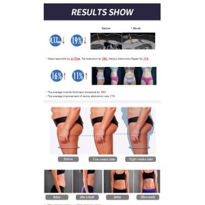 Abdomen EMS EMShapeing Machine Slim Muscle Butt Build For Salon Nova RF