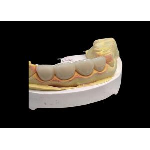 Long lasting Wear resistant Strength all Ceramic Crown Bridge with Excellent