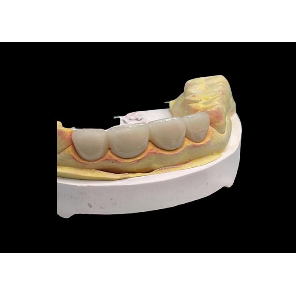 Buy Long lasting Wear resistant Strength all Ceramic Crown Bridge with Excellent Biocompatibility for dental restoration at wholesale prices