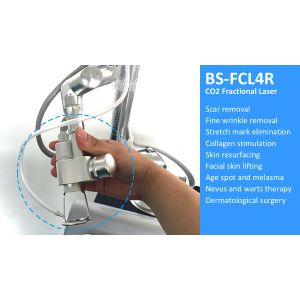 Fractional Co2 Laser For Acne Scars