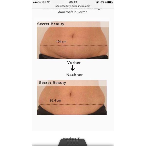 Beautiful Design High Quality Manufacturer Direct Sale Portable Cryolipolysis Machine For