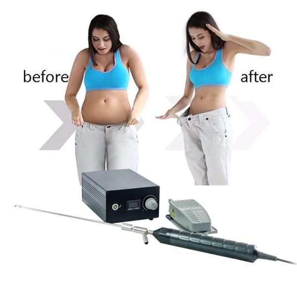 Buy Plastic Surgery Liposuction Electric Vibration Device 300W at wholesale prices