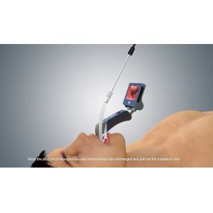 Photo Function Hospital Digital Reusable Video Laryngoscope ISO13485