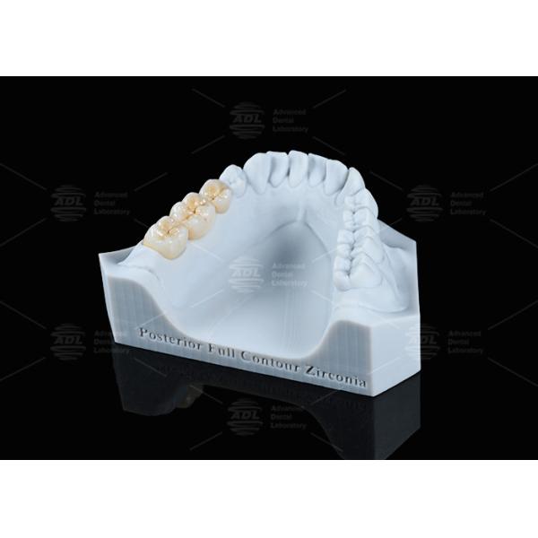 Translucency White Full Contour Zirconia Crown FCZ Monolithic Zirconia Crown