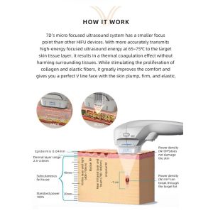 RF Face Wrinkle Removal Machine