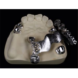 Buy cheap Telescope Metal Crown And Bridge For Dental And Orthodontic from wholesalers