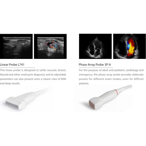 CE approved Sonoscape ultrasound machine Sonoscape X3