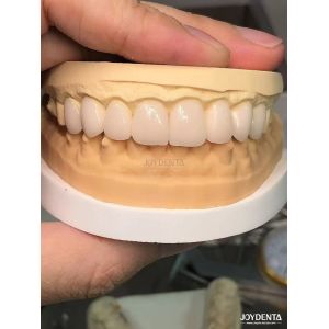 Quality 16 Shades Color Emax Dental Veneers A1-A4 High Stain Resistance For Perfectly Smiles for sale