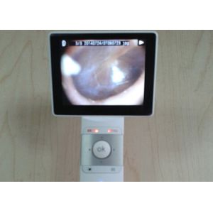 ProfessionalENT Endoscope Ear Camera Digital Video Otoscope With Rechargeable