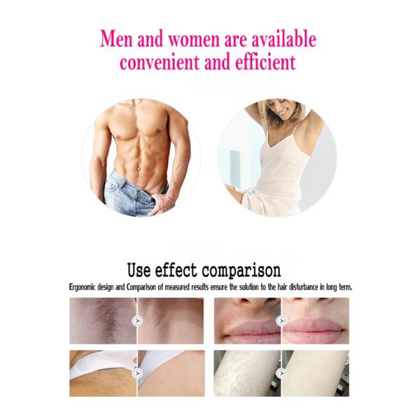 Gold White 300000 Flashes 50 / 60Hz IPL Diode Hair Removal