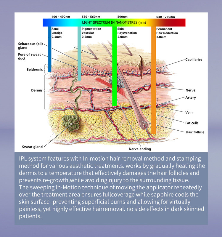 M22 IPL Laser Beauty Equipment Nd Yag Tattoo Removal and Hair Removal Skin