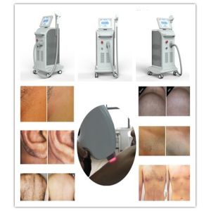 Nubway profesional new hair removal 3 wavelengths 808nm 755nm 1064nm micro