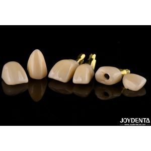 Precision Dental Implant Crown and Bridge Perfect Solution for Aesthetically