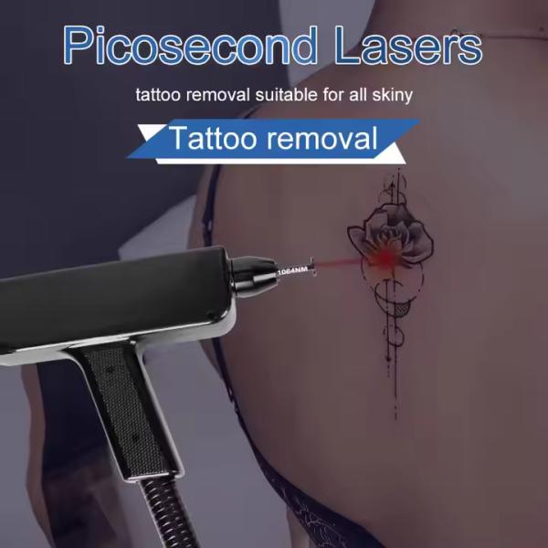 2 IN 1 YAG 4 Wavelength Hair Removal Alexandrite Laser Diode Laser Hair Removal Machine