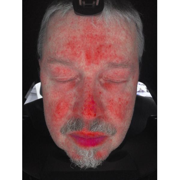 Buy Facial Skin Scanner Analysis , Skin Analyzer Machine With Ce Certificate at wholesale prices