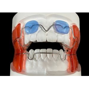 Frankel 2/3 Orthodontic Appliance, enhancing Jaw Alignment in Growing Children