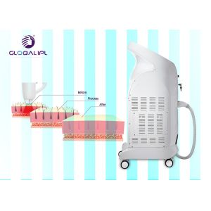808nm Diode Laser Hair Removal Depilation Machine 1-10HZ Frequency