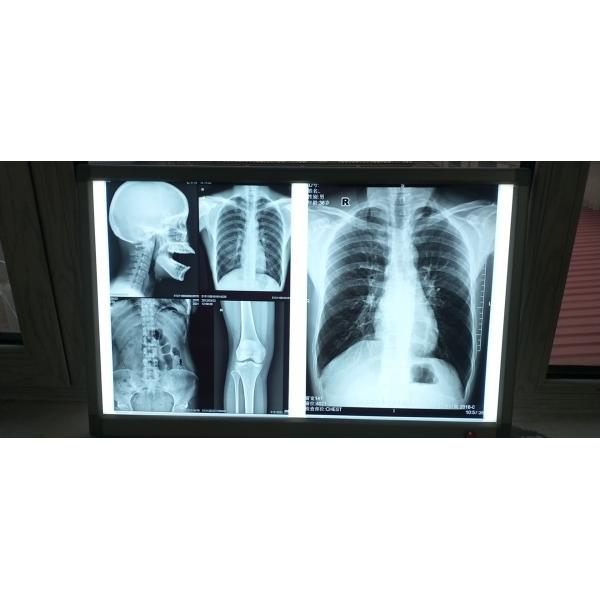 Buy Silk Screen Medical Inkjet Film Glossy Surface Waterproof at wholesale prices