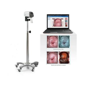 EDAN C3A&C6A Video Colposcope