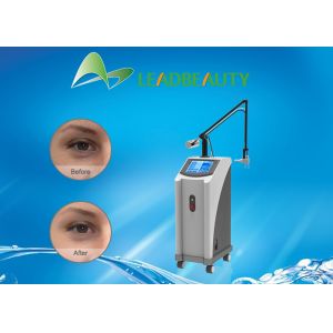 Beauty machine manufacturer RF tube / glass tube co2 fractional laser