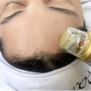 Thermal Cooling Microneedling Fractional RF Face Lifting