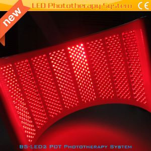 PDT&LED Acne Treatment beauty machine for Blood Vessels Removal