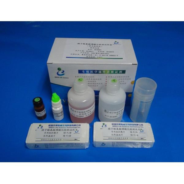 Buy 40T/Kit Sperm Function Test Kit For Determinate Protein Tyrosine Phosphorylation at wholesale prices
