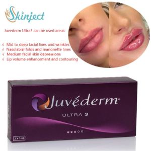 Face Care 2x1ml Juvederm Lip Fillers Hyaluronic Acid Dermal Injectable