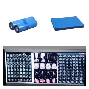 China Medical X Ray Films High Resolution 9600x2400dpi With High Image Stability on sale