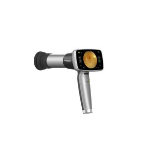 Handheld Digital Fundus Camera