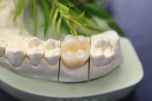 China Design Dental Lab Monolithic Zirconia Dental Crown For Molars Posterior Teeth on sale