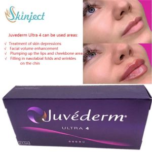 Face Care 2x1ml Juvederm Lip Fillers Hyaluronic Acid Dermal Injectable