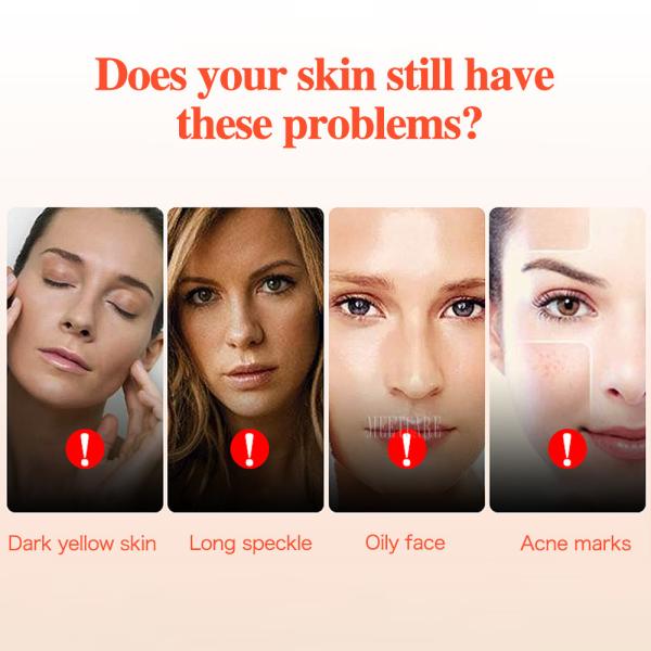 7 Colors Facial LED Mask For Acne Treatment Skin Rejuvenation Wrinkle Removal