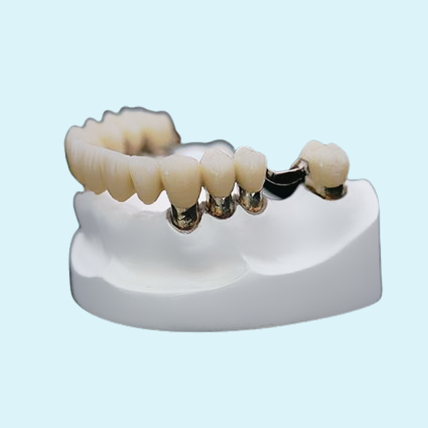 Corrosion Resistance Dental Telescopic Crown Precision Attachment Denture Strong Stability