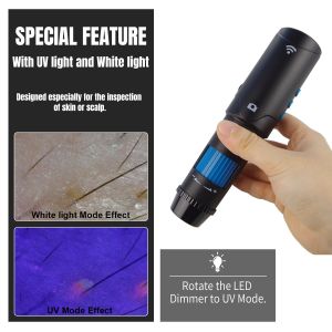 User-friendly Digital Dermatoscope with UV LED Light Source and Long-term