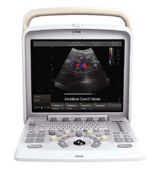 Buy Portable 3.5MHz 7.5MHz 6.0 MHz Ultrasound Scanner Machine For Gynecology at wholesale prices