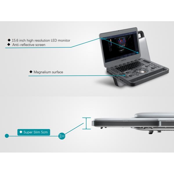 Sonoscape X5 Medical Ultrasound Instruments Machine with Excellent Image Quality