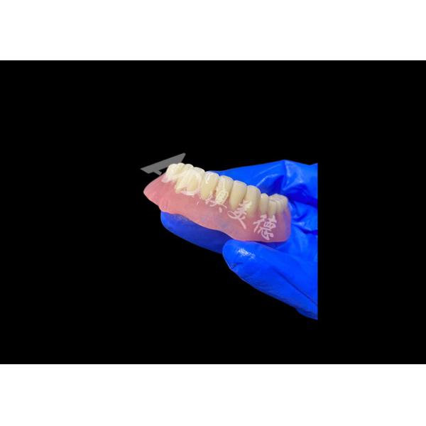 Lightweight Full Acrylic Denture With Metal Framework , Full Arch Removable