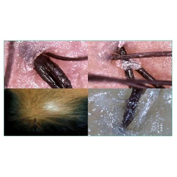 HD 300 Megapixel Skin And Hair Analysis Machine 600X Wireless Hair Scanner Machine