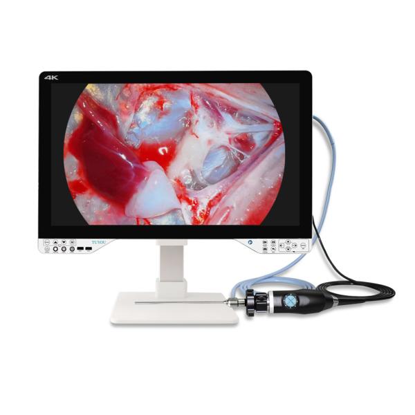 Buy TUYOU Medical 4K All In One Endoscopy Camera System With Light Source And Monitor For Laparoscopic Surgery at wholesale prices