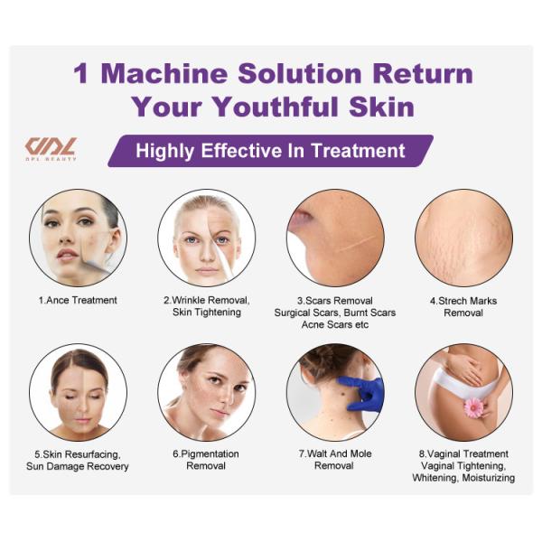 ZGV13-02 Fractional CO2 RF Tube laser machine Private Laser black color salon beauty machine