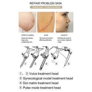 Hot Selling Wholesale CO2 Fractional Laser Equipment +vaginal laser+ cutting