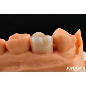 Dental Multilayer Full Zirconia Crowns And Bridges High Translucent Natural